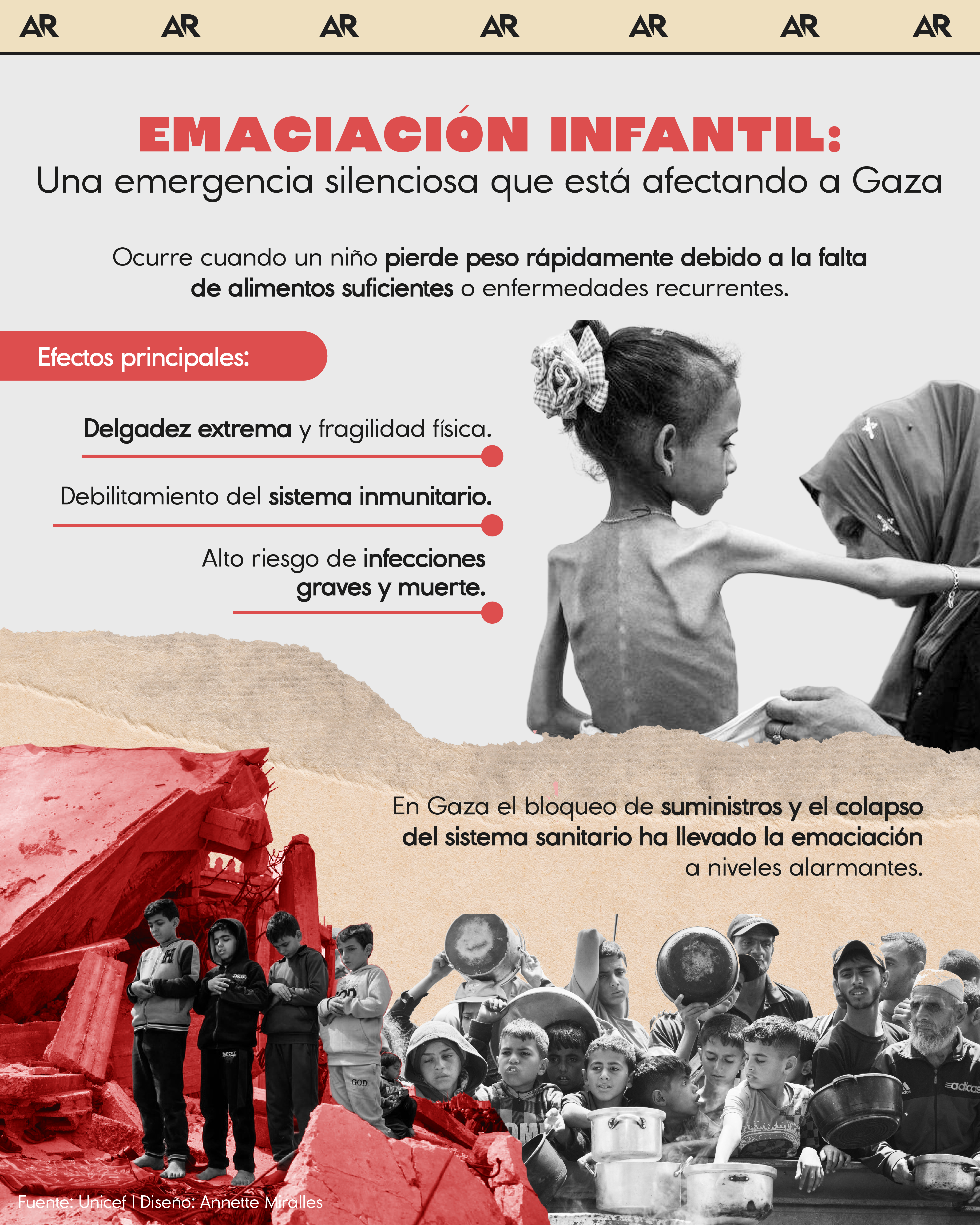 La emaciación infantil: Una emergencia silenciosa que está afectando a Gaza