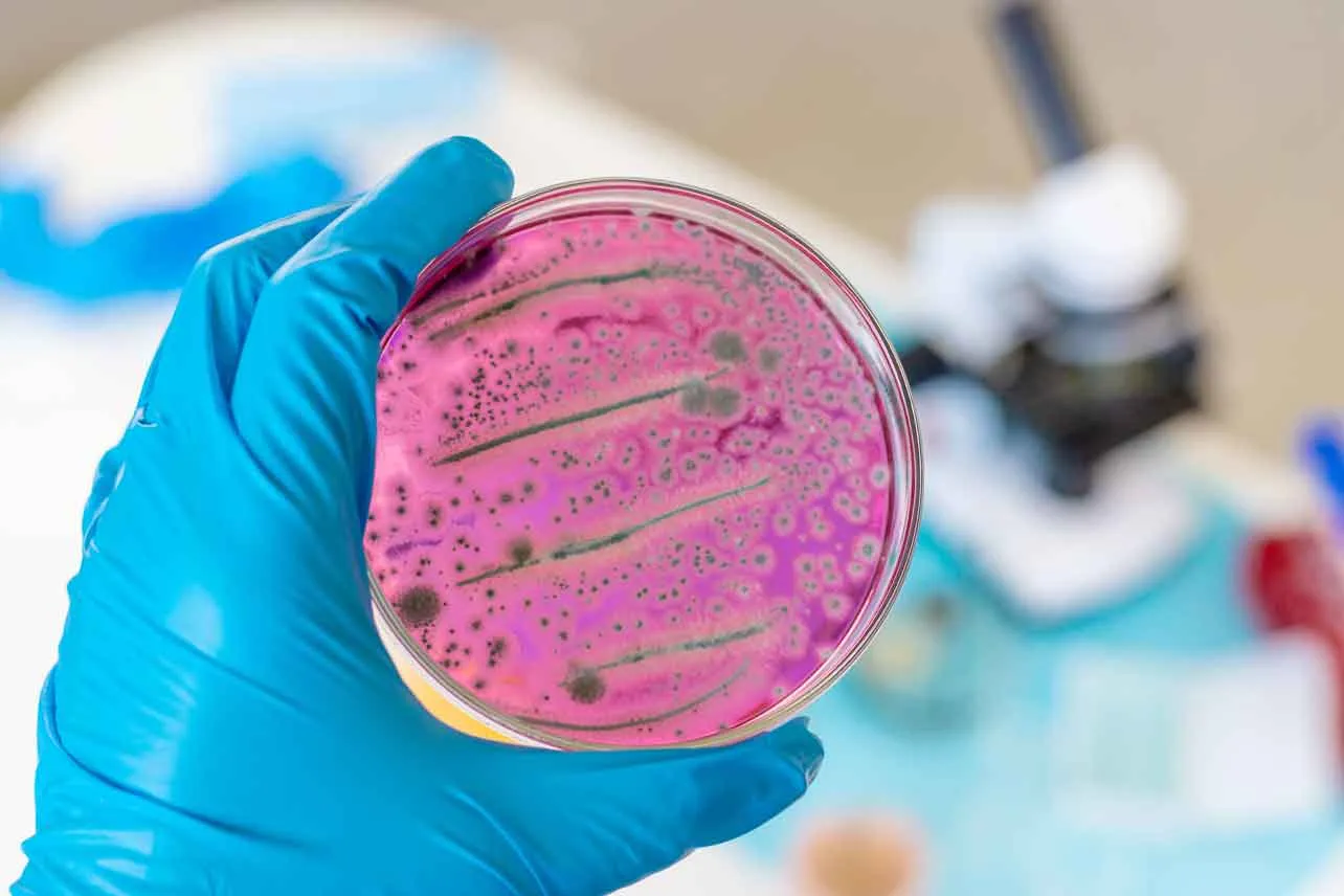 brote, salmonella, CIMA
