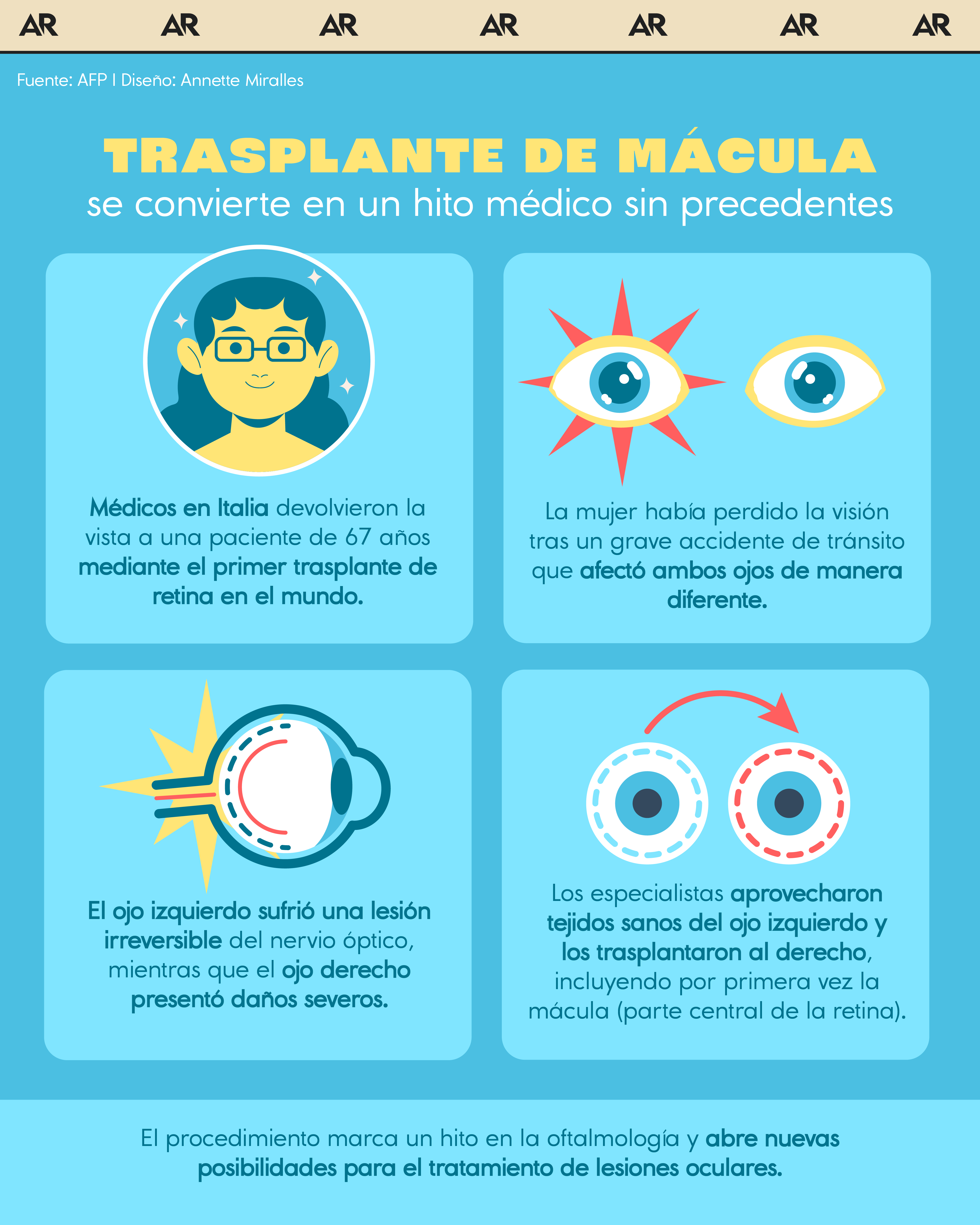 ¿Cómo un trasplante de mácula realizado en Italia se convirtió en un hito médico sin precedentes?